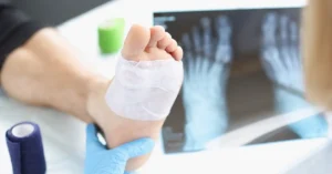 skin graft on a foot in a doctor's office